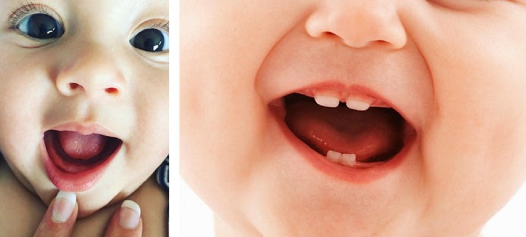 Can I use frozen items to soothe teething pain